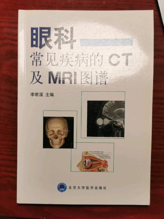 眼科常见疾病的CT及MRI图谱