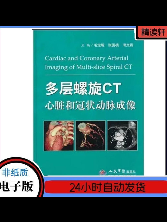 多层螺旋CT心脏和冠状动脉成像
