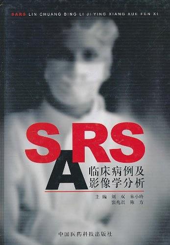 SARS临床病例及影像学分析