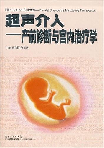 超声介入