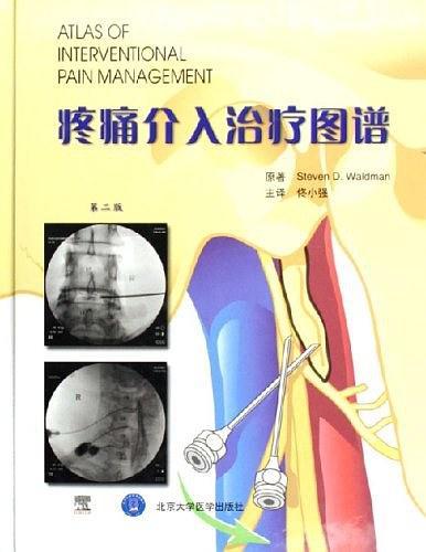 疼痛介入治疗图谱